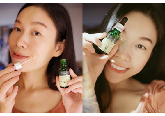 暗瘡粉刺總是常出現?好用暗瘡護理推介!